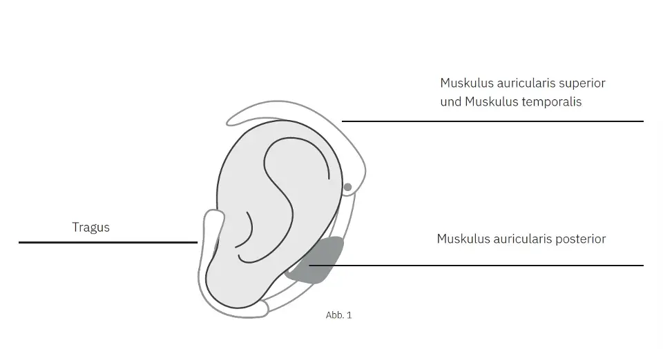 Abbildung Wirkungsbereiche ForgTin Ohrbügel